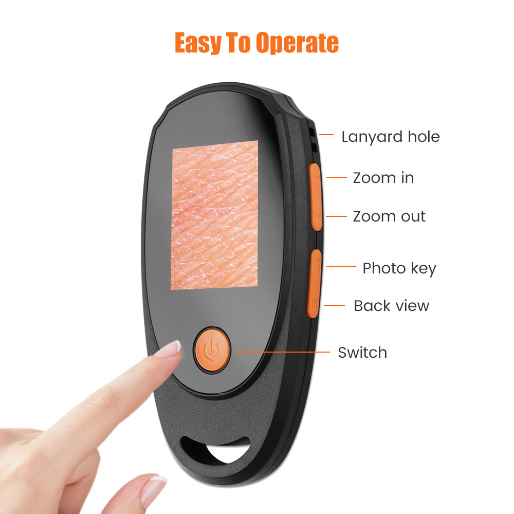 Dermatoscope Skin Analyzer Machine Digital Microscope Camera WiFi ...