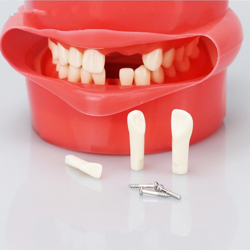 Tooth Model Resin Removable Teeth Model Student Studying Model Dental ...