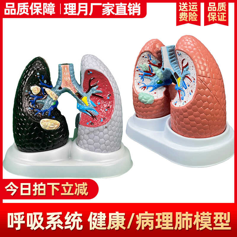Human lung model smoking cancer lung respiratory specimens healthy lung ...