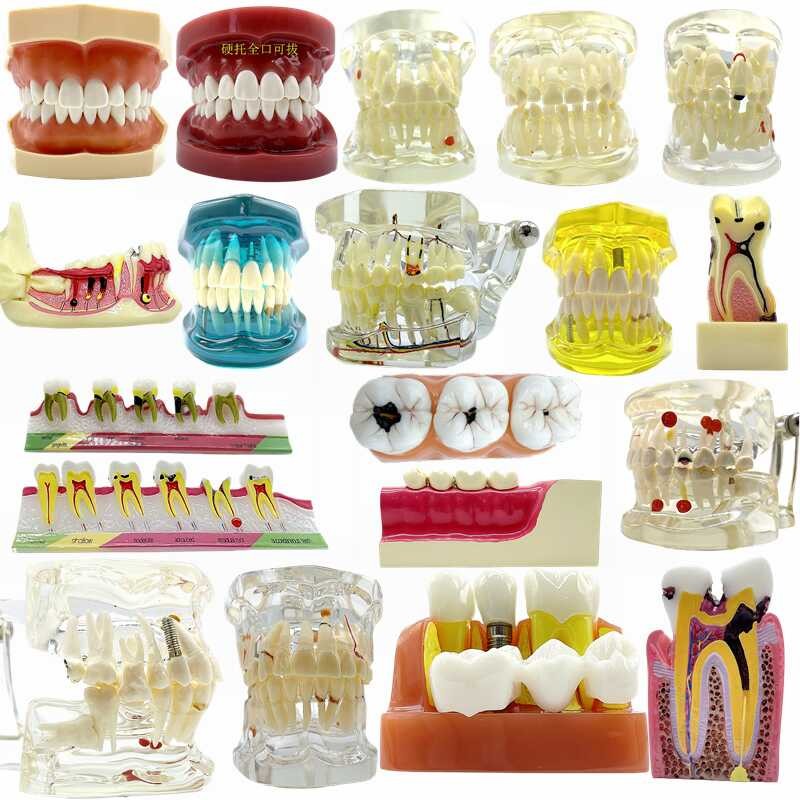 Dental dental model, oral teaching model, orthodontic implant ...