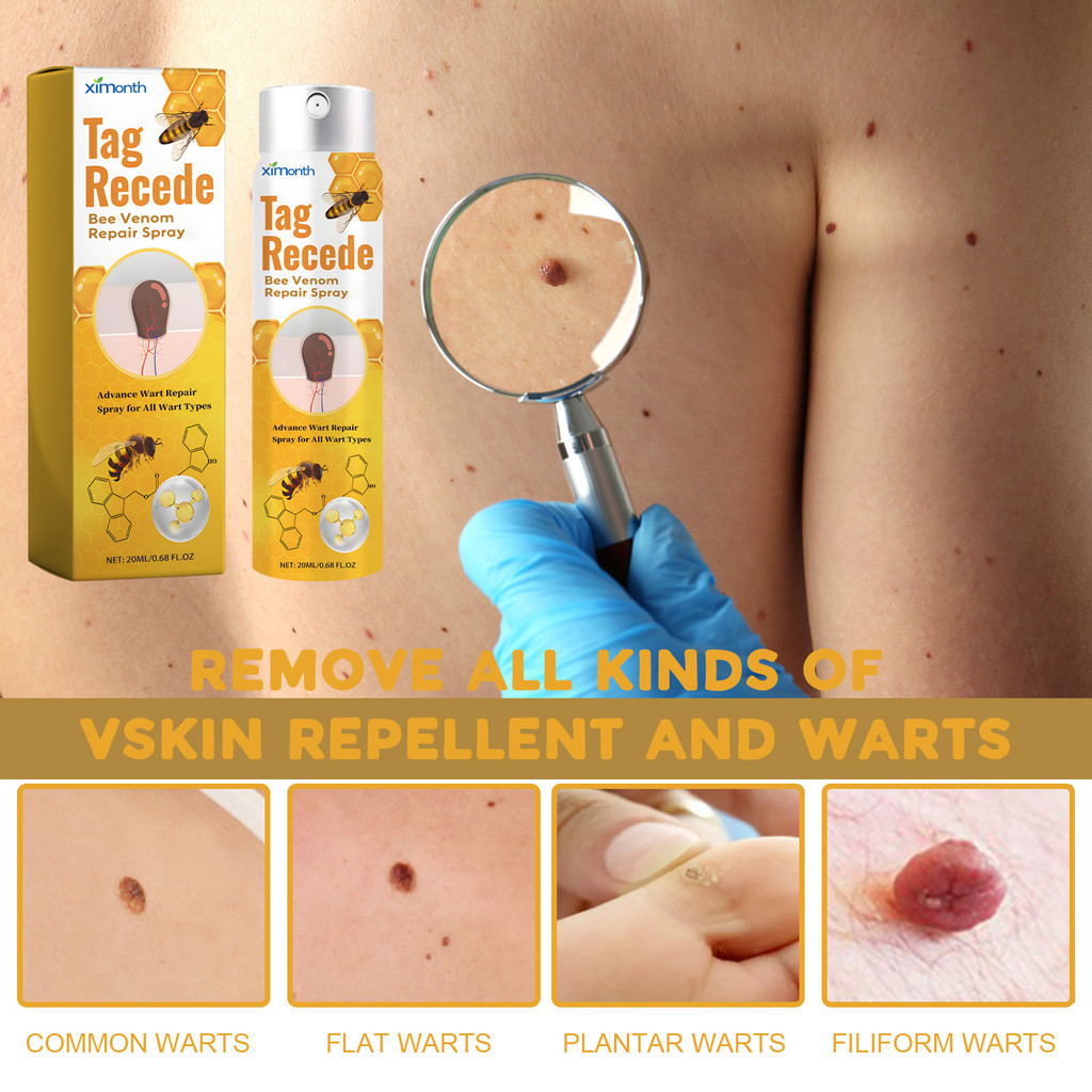 Bee Venom Remover Skin Tag Remover Useful Bee Venom Spray Tag Recede ...