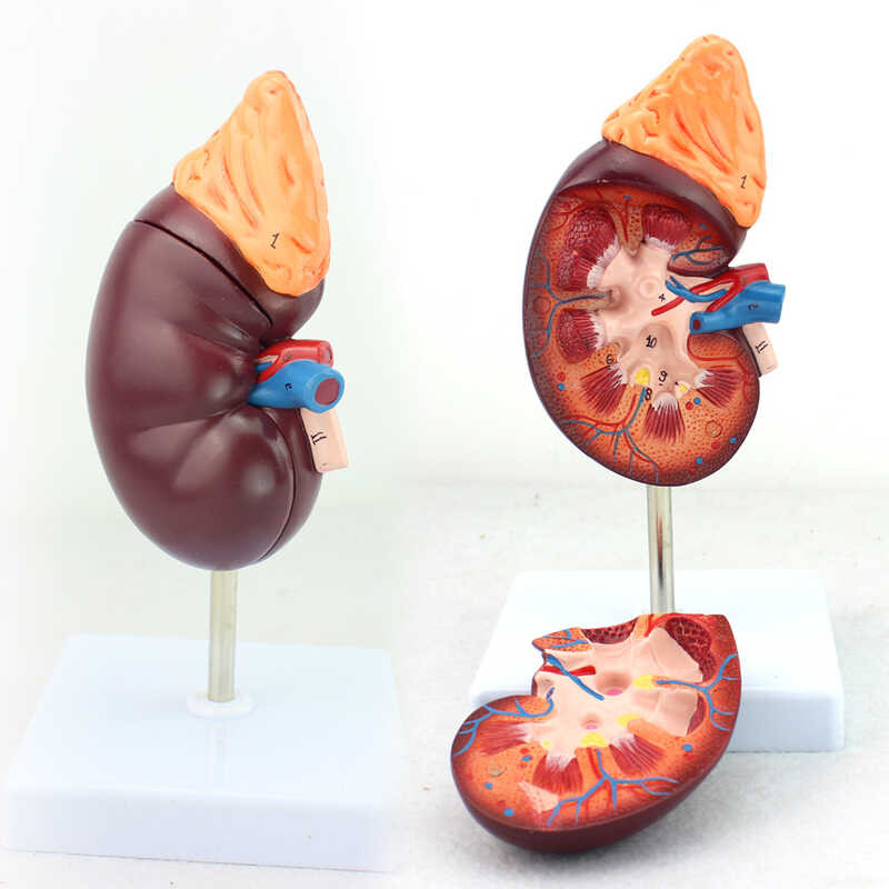 Medical Human Kidney Anatomy Model Kidney Model Medical Urology Anatomy ...
