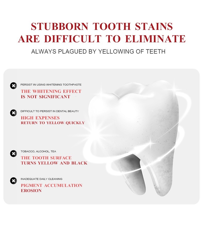 SP7 Probiotic Toothpaste/Whitening Toothpaste Tartar Removal Tooth ...