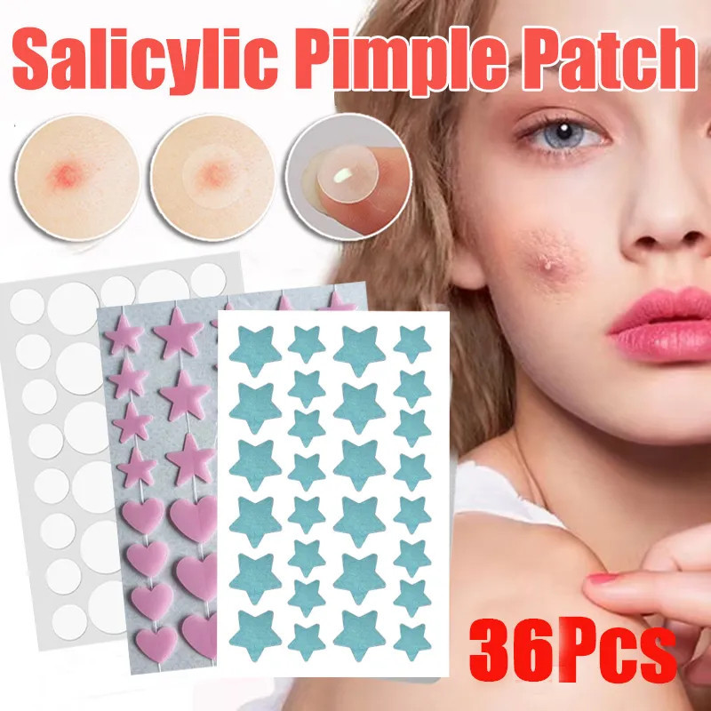 Acne Patch Colorful Star Makeup Concealer Paste Water Colloid Skin Care ...