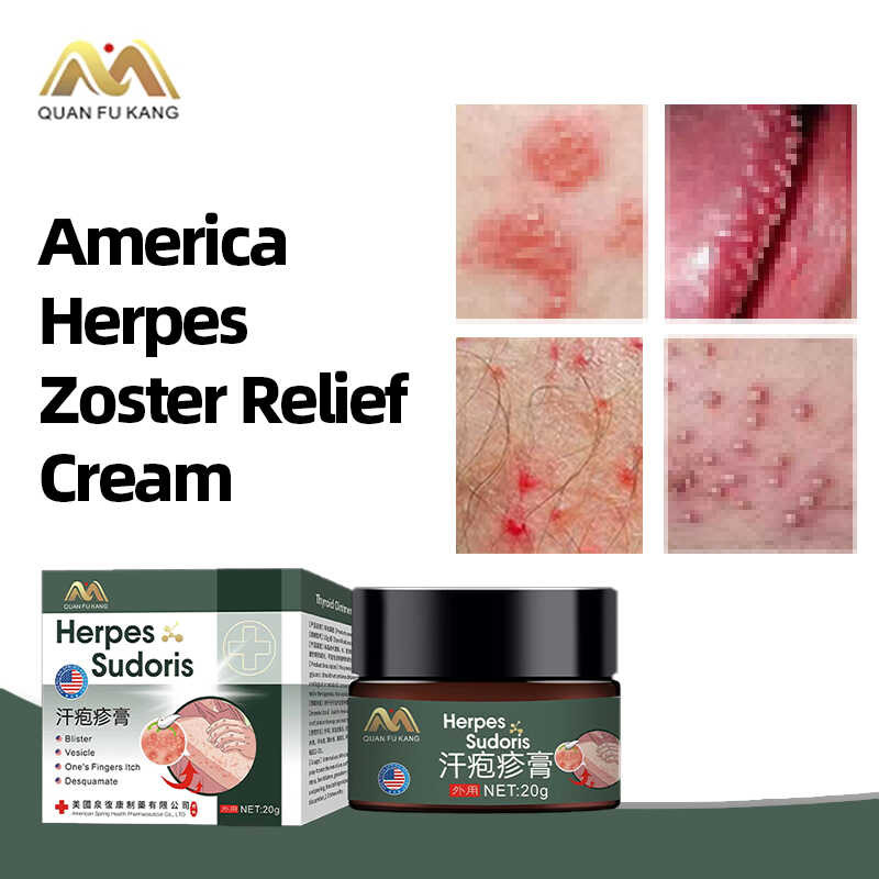 Zoster Treatment Medicine Cream Herpes Simplex Skin Ointment Snake Sore ...