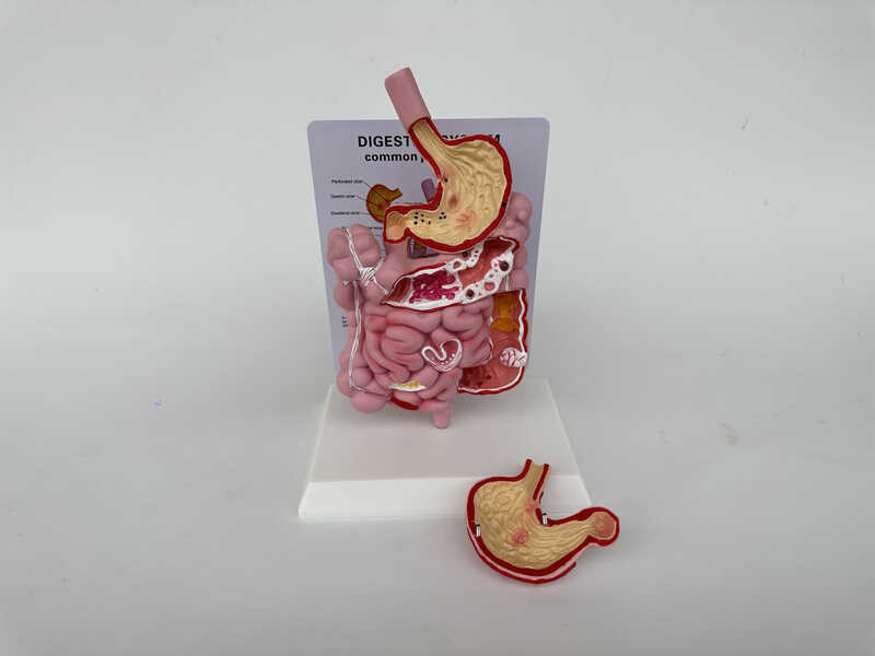 Human digestive system anatomical model, large intestine model, rectum ...
