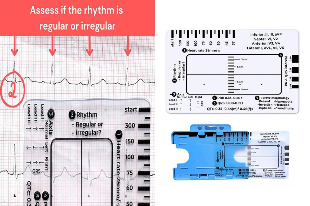 7 Step Ruler Rhythm Assessment Tool Portable Ecg-interpretation Pocket ...