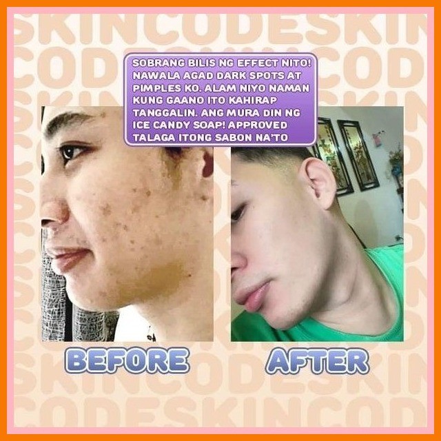 Skin Code Ice Candy Soap Skin Code | Shopee Philippines