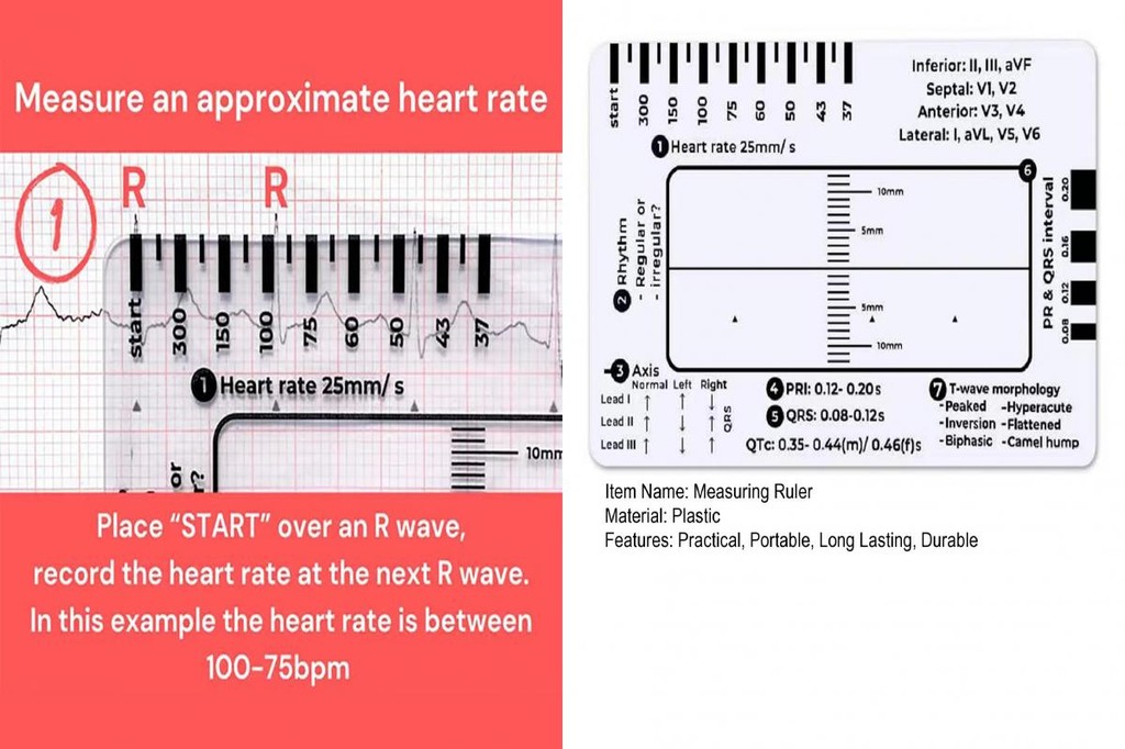 Produktbild von VARKAGE EKG/ECG 7-Schritt Lineal – Tragbare Referenzkarte Für Herzfrequenz, Rhythmus & Achsenabweichungen