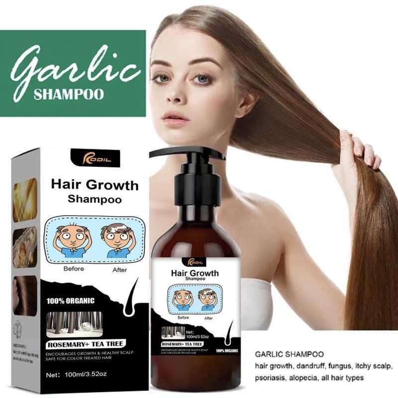 Hair Growth RODIL Garlic Shampoo,Herbal Essences Anti Dandruff Shampoo ...
