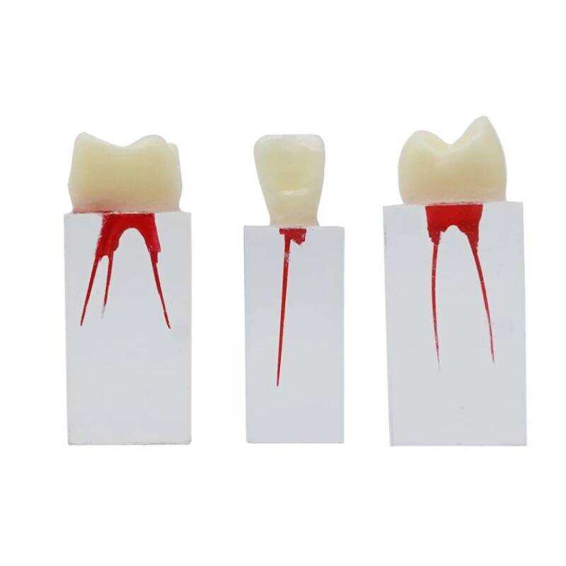 Endodontic 3Pcs Dental Root Canal Blocks Endo Pulp Cavity RCT Practice ...