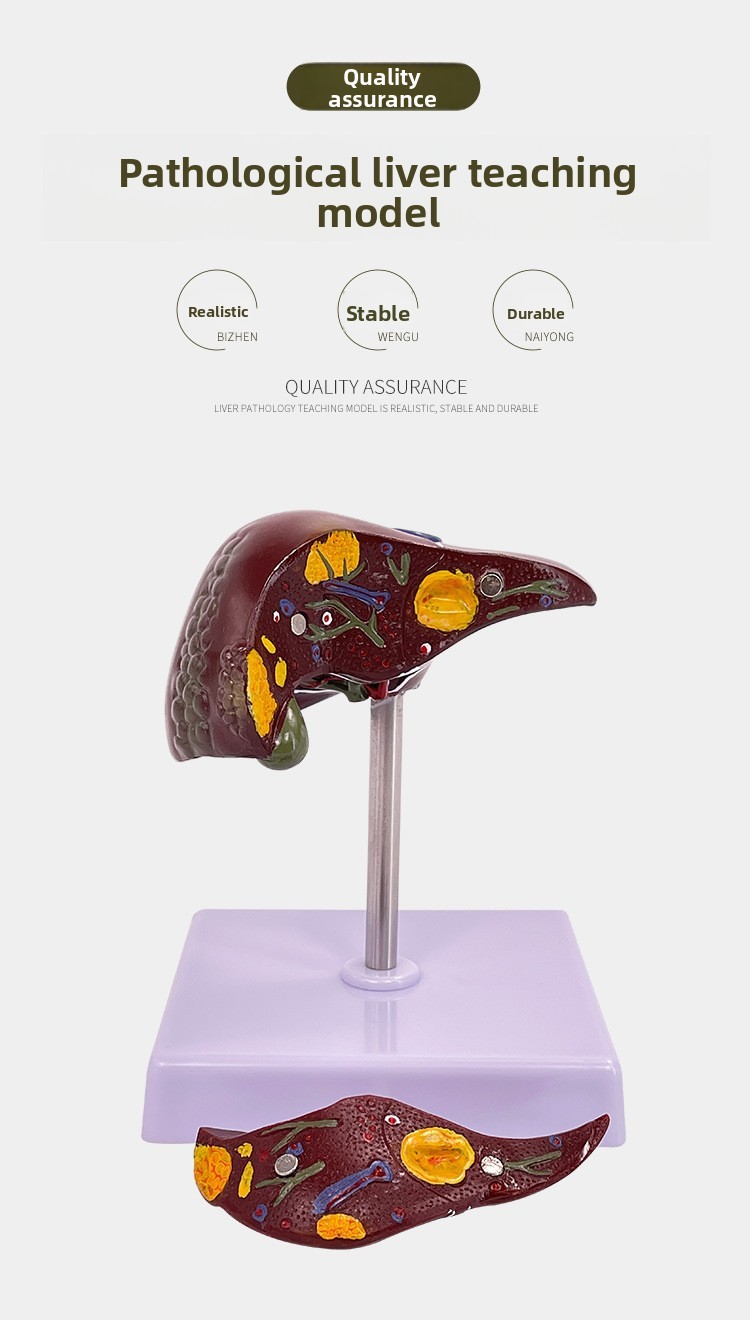 Liver Pathology Model Fat Model Liver and Gallbladder Model Lesion ...