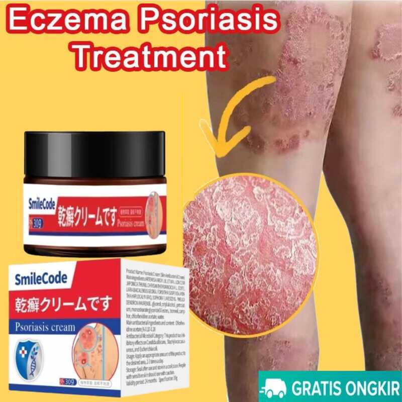Eczema Treatment Cream Original Gamot Balat Ointment Eczema Treatment ...