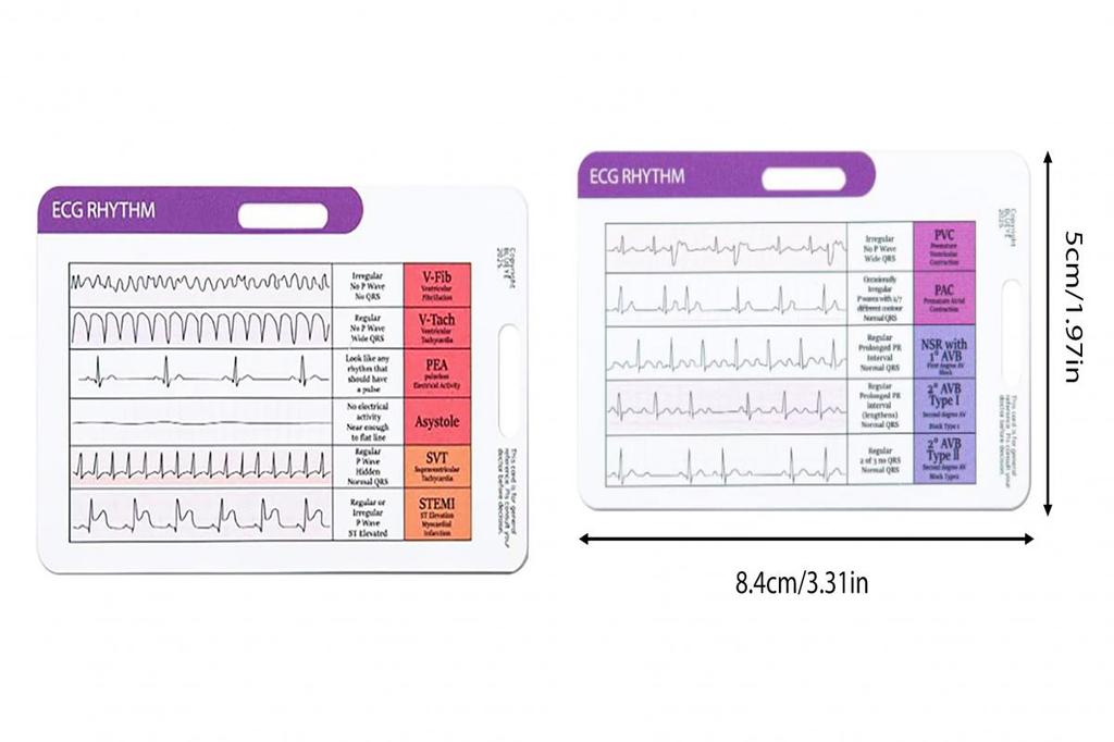 [Nice] Ekg Rhythm Card Ekg Waveform Card Portable Ekg Rhythm ...