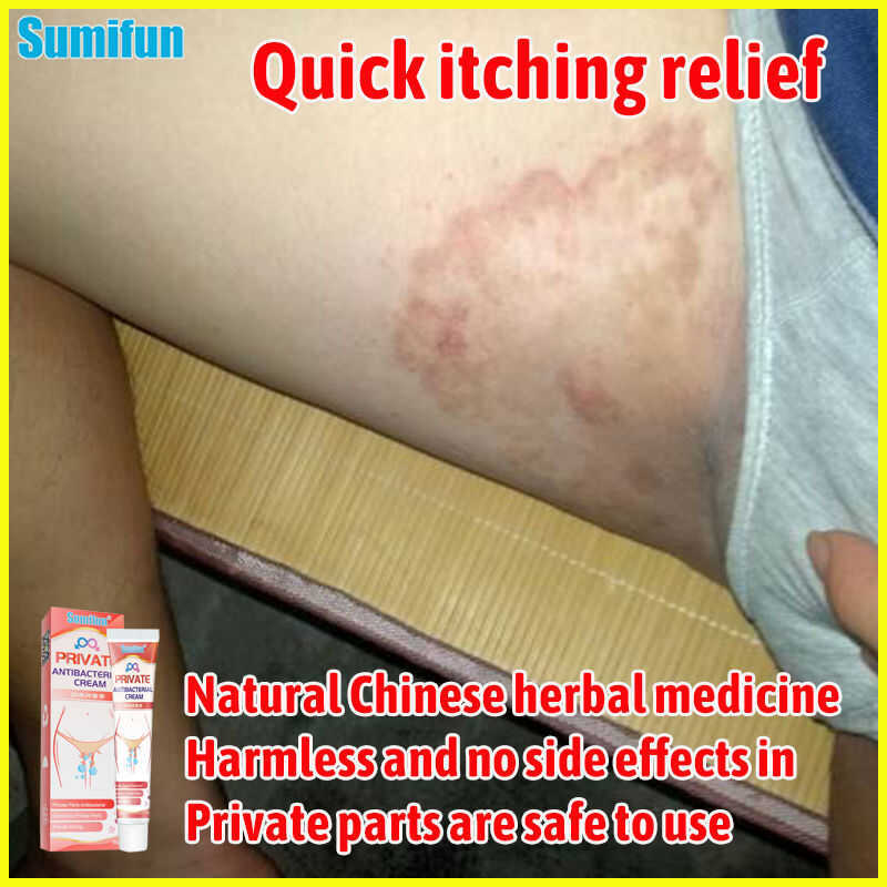 SUMIFUN Ointment For Itchy Skin And Allergy Skin Cream Mosquito Bite ...