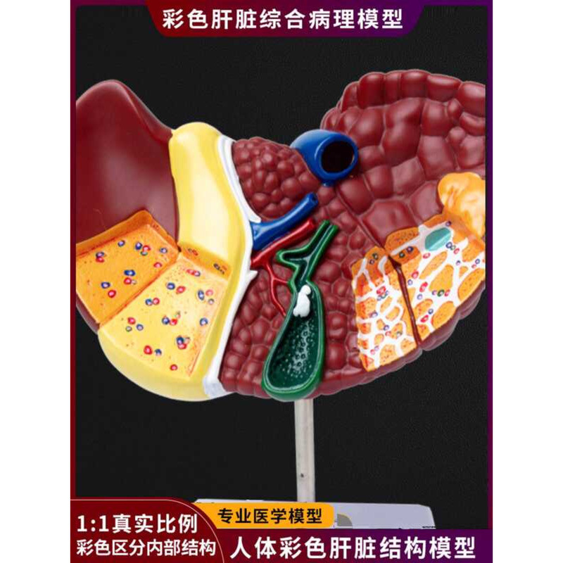 Medical Simulation Human Anatomy Model Liver Door Gallbladder Biliary ...