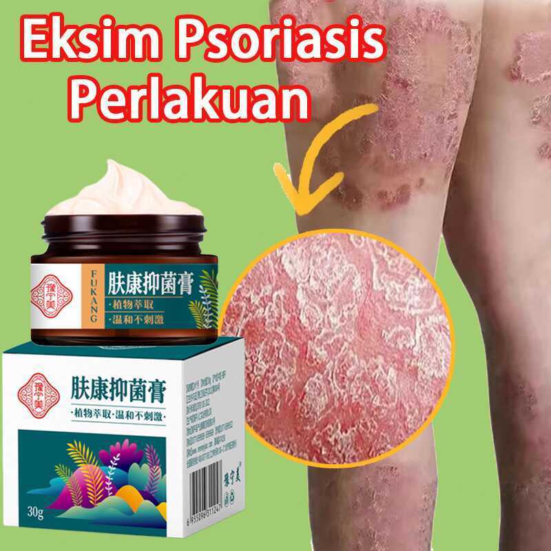 B3 【Gamot Sa Kati Kati】Eczema Treatment Cream Atoderma Original Gamot ...