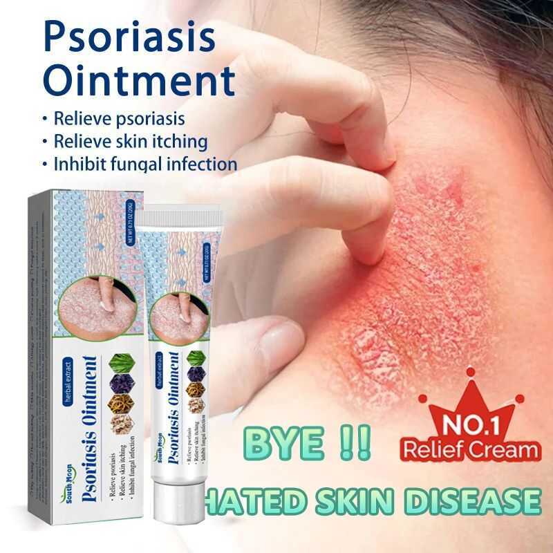 COD Psoriasis Cream Dermatitis Eczematoid Eczema Antibacterial Ointment ...
