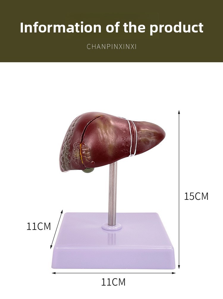 Liver Pathology Model Fat Model Liver and Gallbladder Model Lesion ...