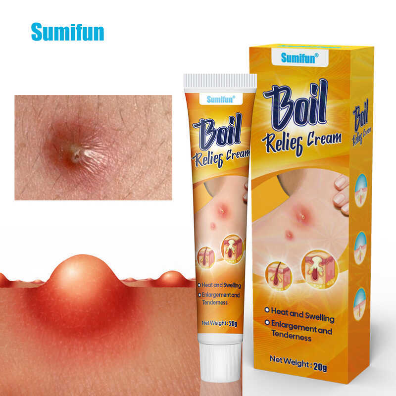 20G Boils Treatment Cream Relieve Suppurative Skin Abscesses ...
