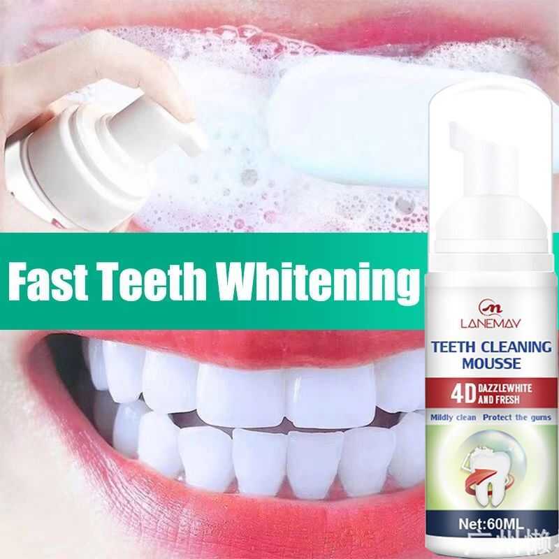 Teeth Whitening Mousse Toothpaste Kit Oral Tooth Hygiene Cleaning ...