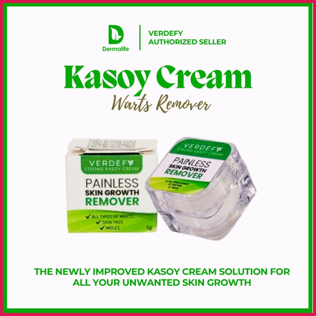 Kasoy Cream Mole Remover Warts Skin Tag | Shopee Philippines