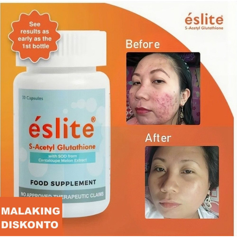 eslite glutathione review benefits What are Benefits? Uses & Side effects Explained Glutathione Benefits For Your Health  A very honest review... With