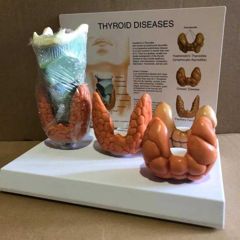 Teaching Model Thyroid Lesion Model Anatomical Model Medical Textbook ...