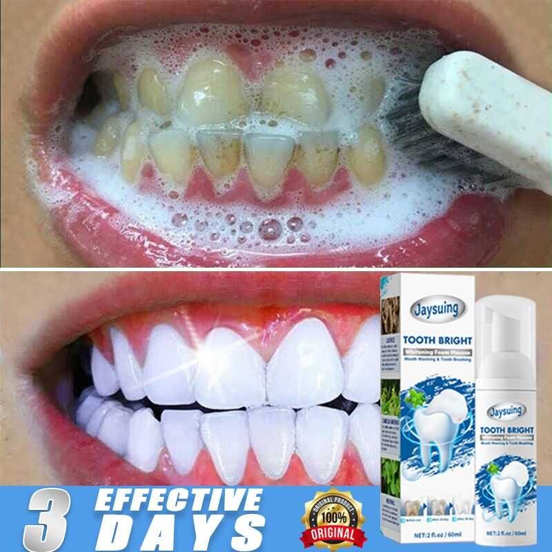 Hunmui Toothpaste Original Niacinamide Japan Whitening For Teeth Stain ...