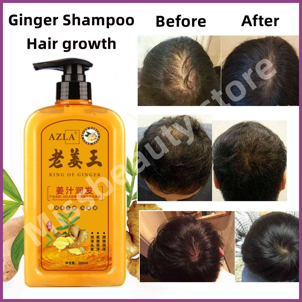 AZLA Ginger Shampoo Anti-Hair Loss Shampoo Rapid Regrowth Hair Anti ...