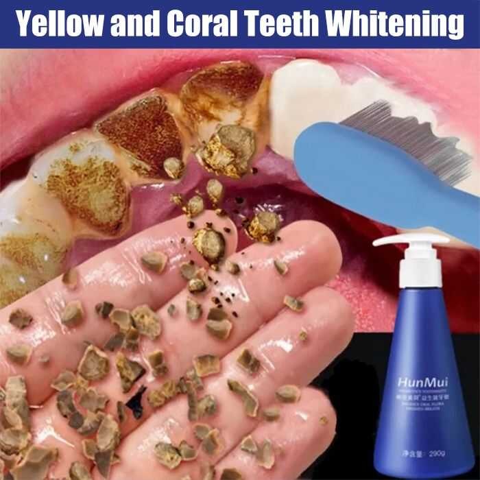 Hunmui COD Niacinamide Whitening Probiotic Toothpaste Menyingkirkan ...