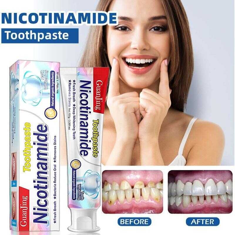 Gum Care Niacinamide Whitening Mint Toothpaste Removes Teeth Stains And ...