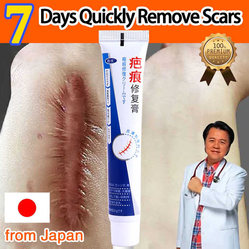 Scar Remover Cream Gel From Japan Original By Doc Willie Ong For Old ...