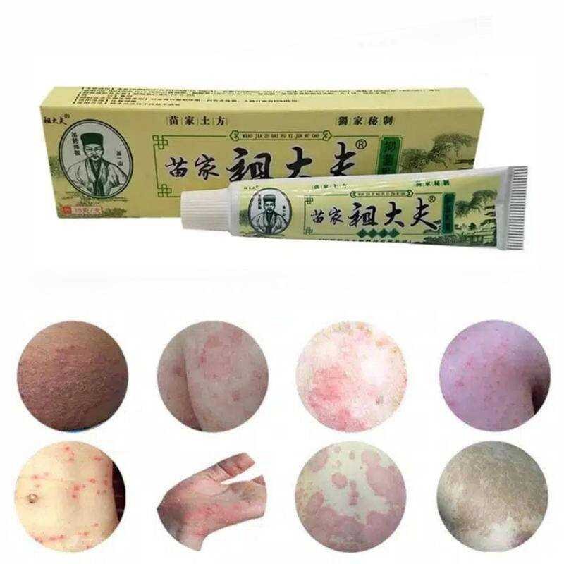 Zudaifu Skin Herbal Psoriasis Dermatitis Eczema Pruritus Cream Ointment ...