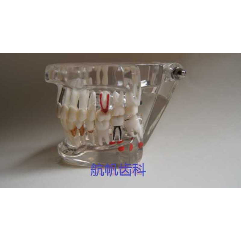 Oral Removable Materials Dental Teaching Movable Teeth Adult Pathology ...