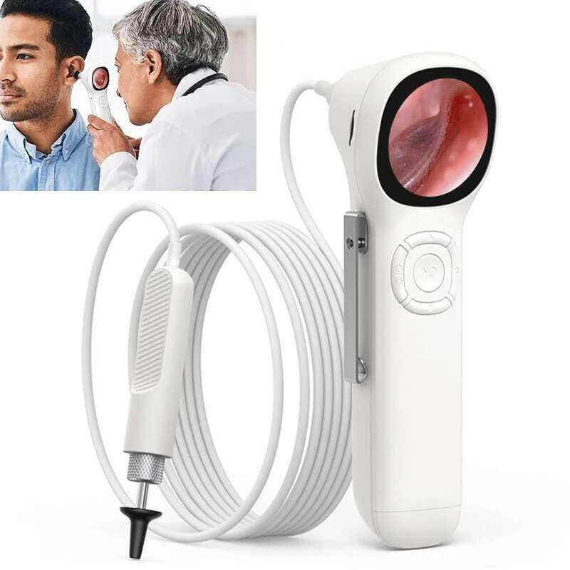 Tt 3.9Mm Rechargeable Ear Care Nose Visual Smart Direct Endoscope HD ...