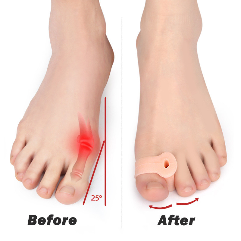 1pair Toe Separator Bunion Corrector Gel Toe Spacer Toe Protector ...