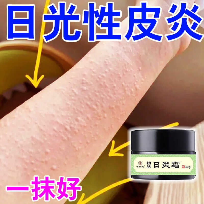 Allergy UV Dermatitis Sunburn Itching Peeling Antibacterial Anti-Itch ...