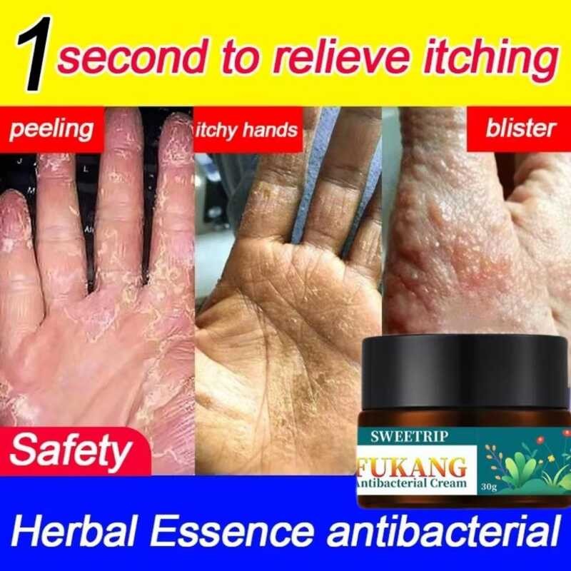 Eczema Treatment Gamot Kati Sa Balat Ointment Herbal Antibacterial ...