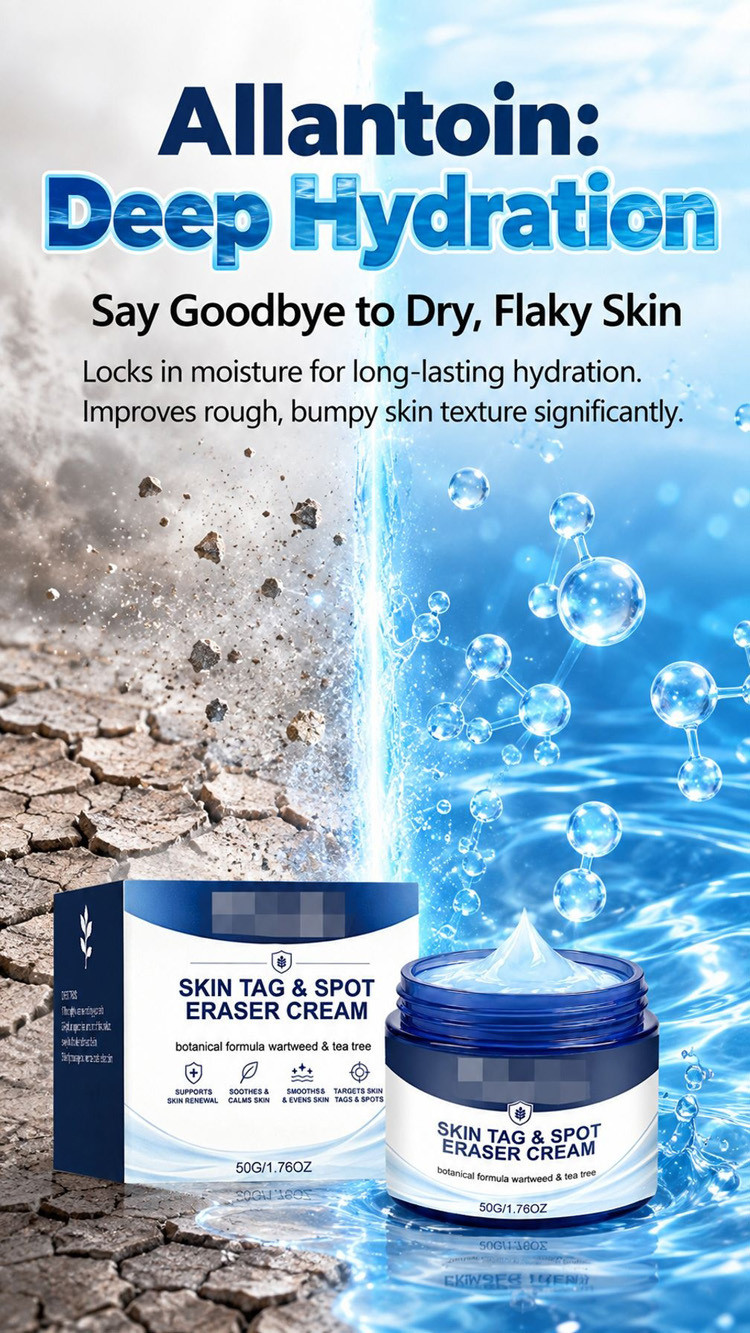 Original Genuine 7 Days Fast Skin Growth Remover Cream / Skin Tag Mole ...