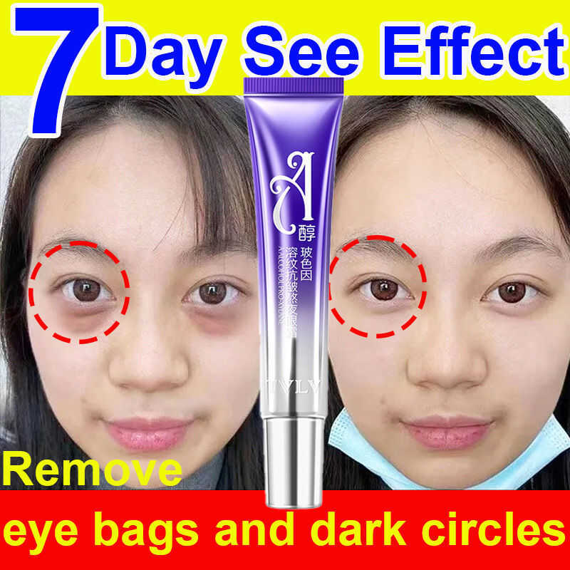 Original Eye Cream 30G Wrinkles Eyebag Panda Balm For Dark Under Remove ...