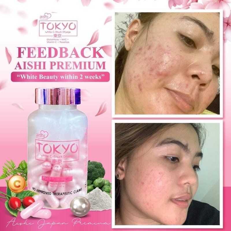 aishi tokyo glutathione review 60 Capsules NAC Vitamin C + Rosehip 9A0 + Vitamin B12 Injections for Glutanex Glow Sun Cream Cover Color or Pattern:Feathers / Critters / Dragons / Midnight Blue
