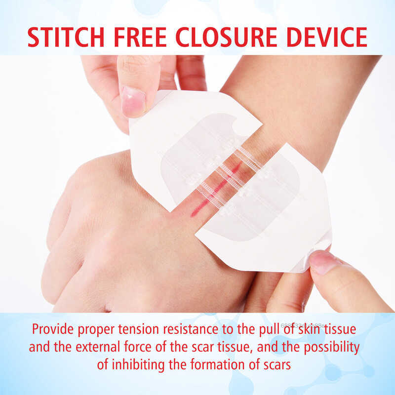 Emergency Closure Device Adhesive Waterproof Care Bandages Gently Pull ...