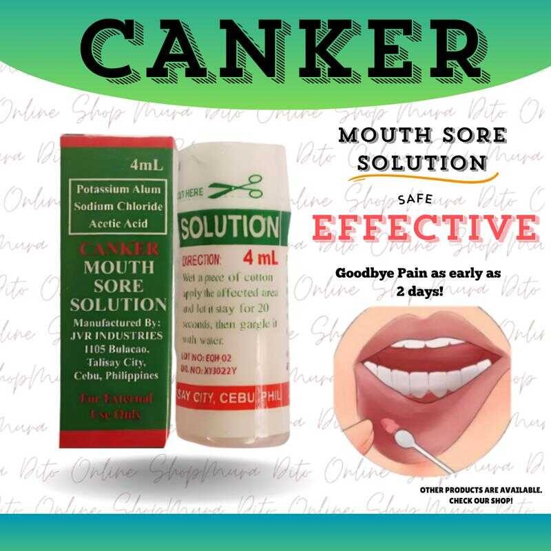 CANKER MOUTH SORE SOLUTION SINGAW TREATMENT ORAL | Shopee Philippines