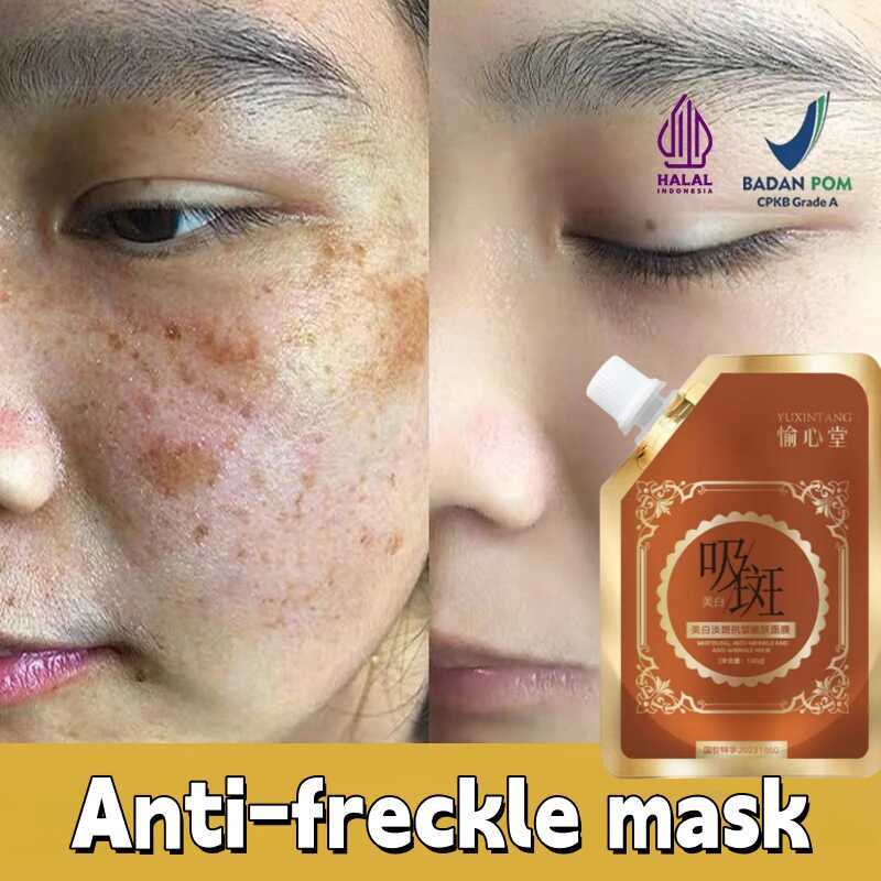 Effective Freckle Mask Remove Dark Spots Witening Fade Acne Scars ...