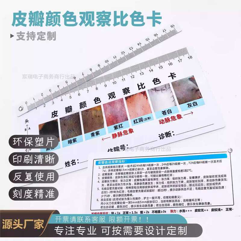 Printed Flap Color Colorimetric Card Medical Skin Grafting Surgery ...