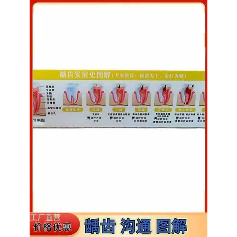 Dental Clinic Endodontic Root Canal Treatment Procedure Chart Medical ...