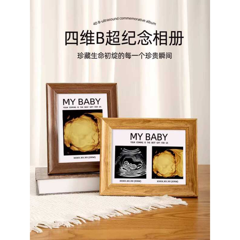4D Ultrasound Photo B-Ultrasound Frame Display NTB Print Pregnancy Baby ...