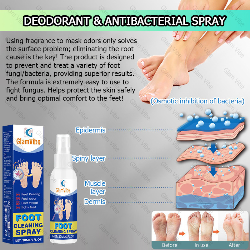 Foot & Toe Fungus Treatment Spray - Relieves Itching, Cracking ...