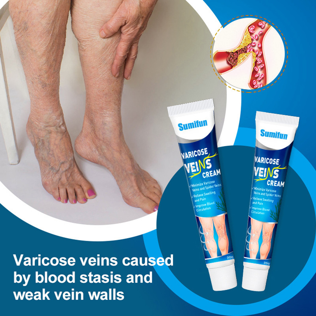 GO8 20g Varicose Vein Cream Easy to Absorb Repair Swelling Synthetic ...